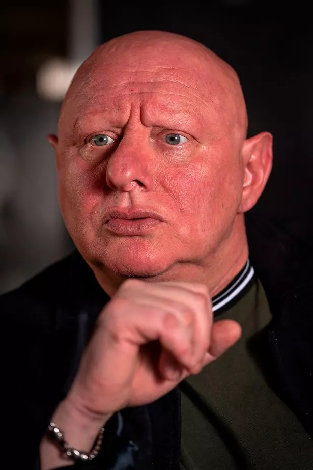 Http://fanpagepress.net/m/S/Shaun Ryder New Pic 1