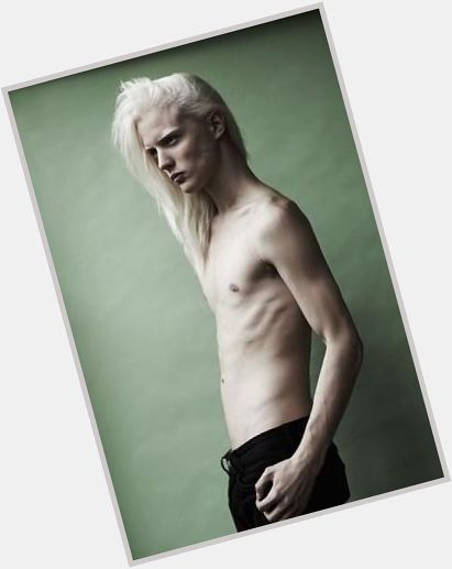 Https://fanpagepress.net/m/D/Dylan Albino Dating 2